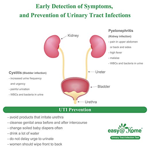 Easy@Home (UTI-20P) Urinary Tract Infection Test Strips (UTI Test Strips), 20 Tests/Box 20 Pouches #UTI-IND-1:20