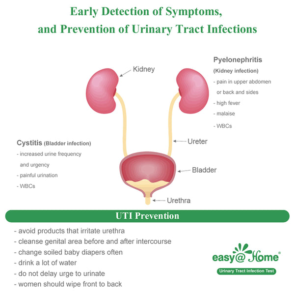 Easy@Home UTI Tests Urinary Tract Infection 50 Pouches/Box UTI-Pouch-50