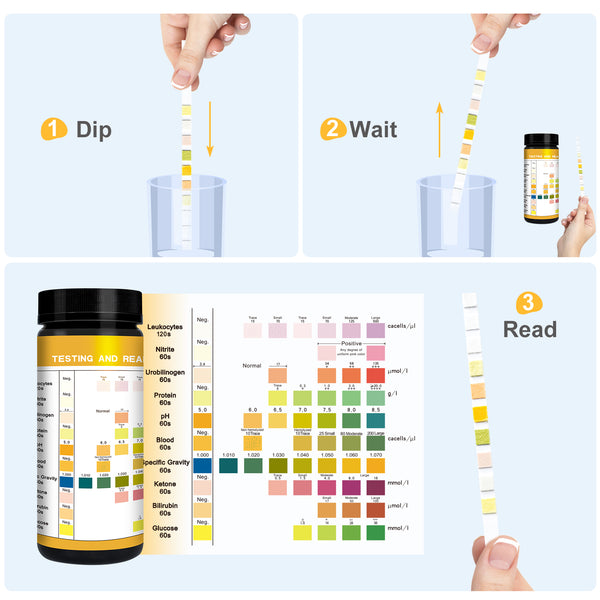 Easy@Home Pet Urine Tests: Vet-10 Urine Test Strips for Dogs & Cats 10 Parameters Animal Urinalysis Reagent Strips - Detect Urinary Tract Infection UTI Diabetes Bladder Kidney Liver Function 100 Counts