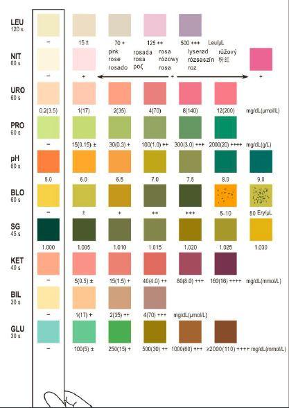 Areta 10 Parameter (10SG) Urinalysis Reagent Test Strips 50 Strips